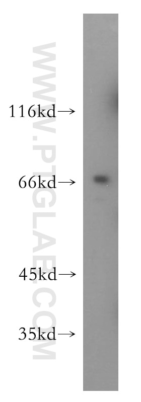 Western Blot (WB) analysis of mouse thymus tissue using GMEB2 Polyclonal antibody (13314-1-AP)