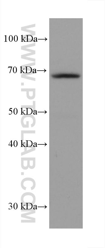 WB analysis of MCF-7 using 68010-1-Ig