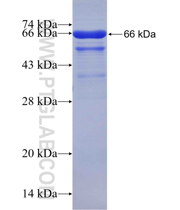 GMEB2 fusion protein Ag4157 SDS-PAGE