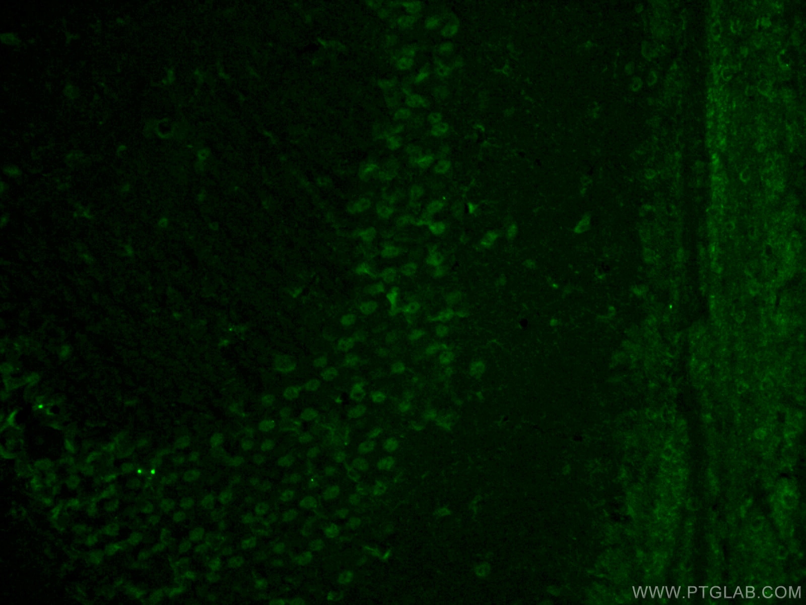 Immunofluorescence (IF) / fluorescent staining of mouse brain tissue using GMF Beta Polyclonal antibody (10690-1-AP)