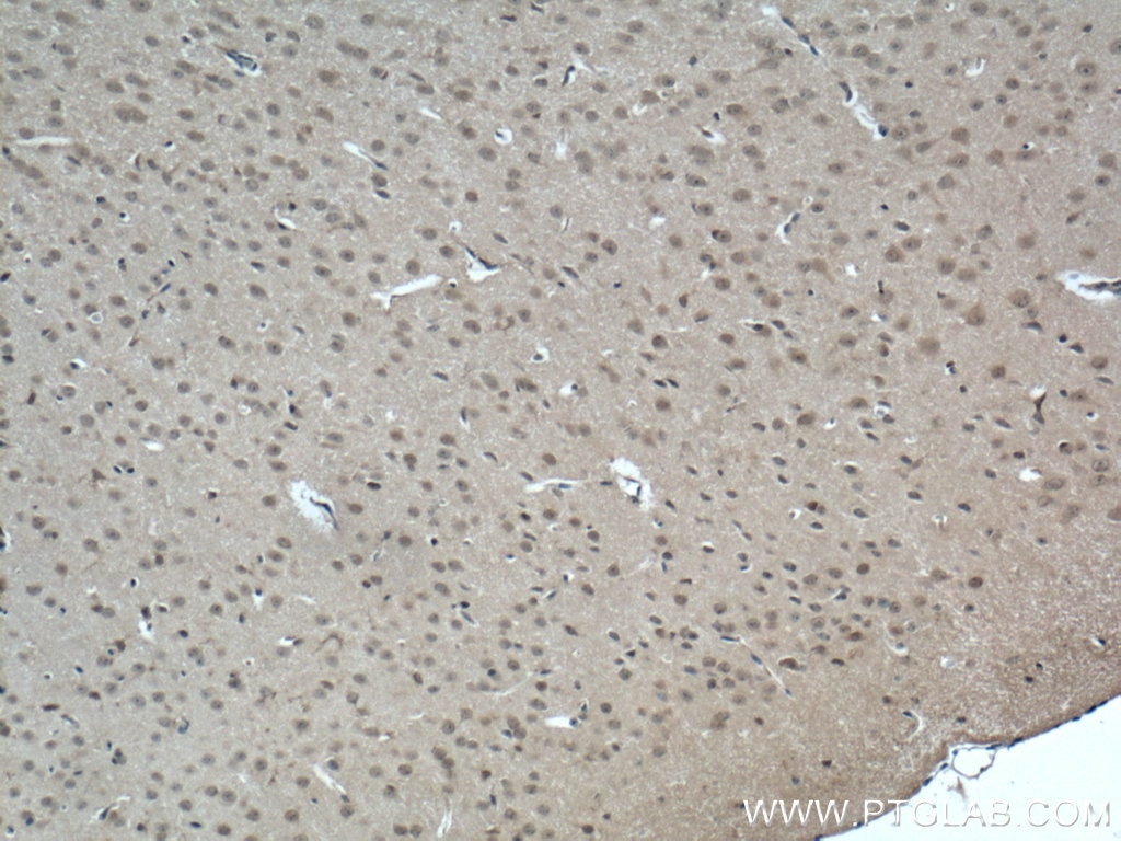 Immunohistochemistry (IHC) staining of mouse brain tissue using GMF Beta Polyclonal antibody (10690-1-AP)