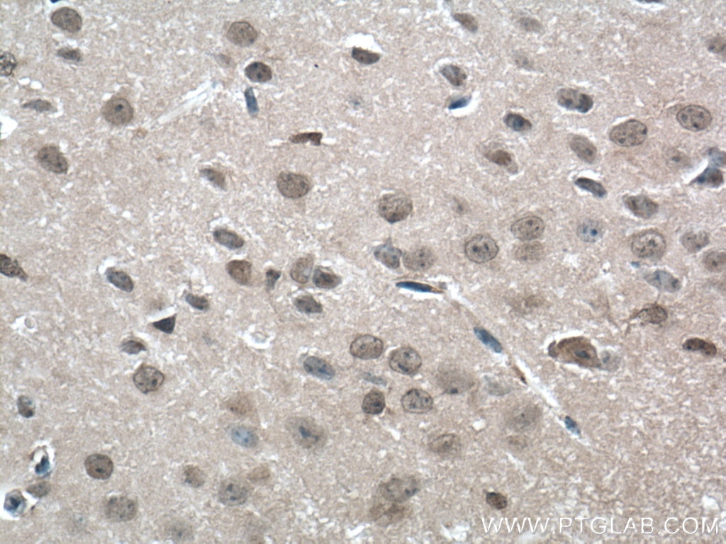 Immunohistochemistry (IHC) staining of mouse brain tissue using GMF Beta Polyclonal antibody (10690-1-AP)