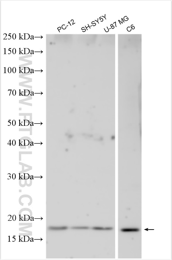 Western Blot (WB) analysis of various lysates using GMF Beta Polyclonal antibody (10690-1-AP)