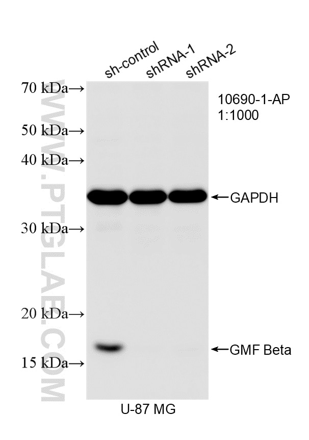 Western Blot (WB) analysis of U-87 MG cells using GMF Beta Polyclonal antibody (10690-1-AP)
