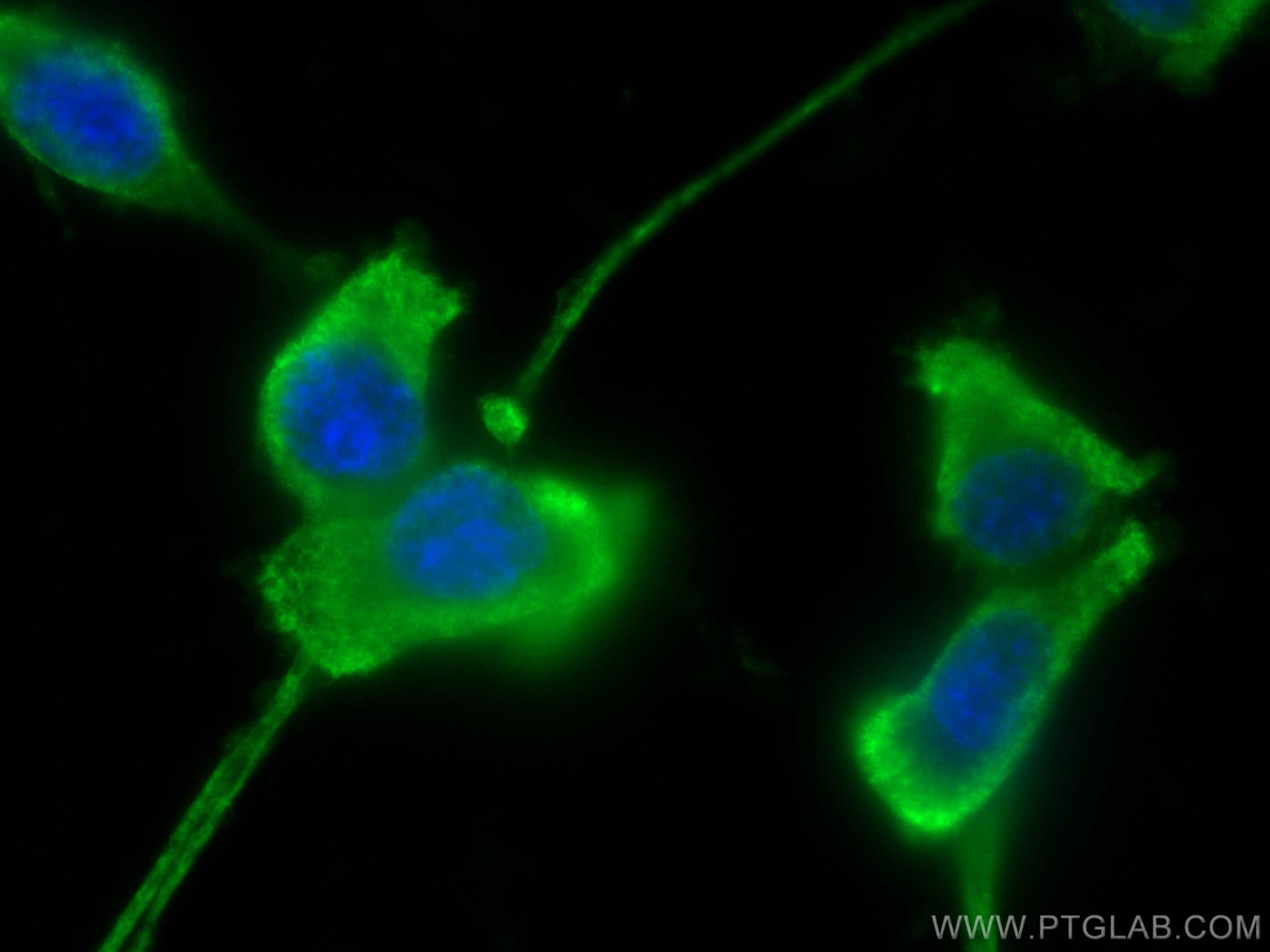 Immunofluorescence (IF) / fluorescent staining of U-87 MG cells using GMF Beta Monoclonal antibody (60062-1-Ig)