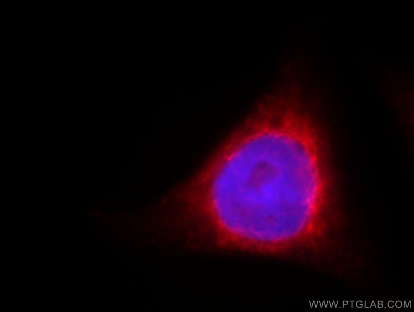 Immunofluorescence (IF) / fluorescent staining of HeLa cells using GMF Beta Monoclonal antibody (60062-1-Ig)