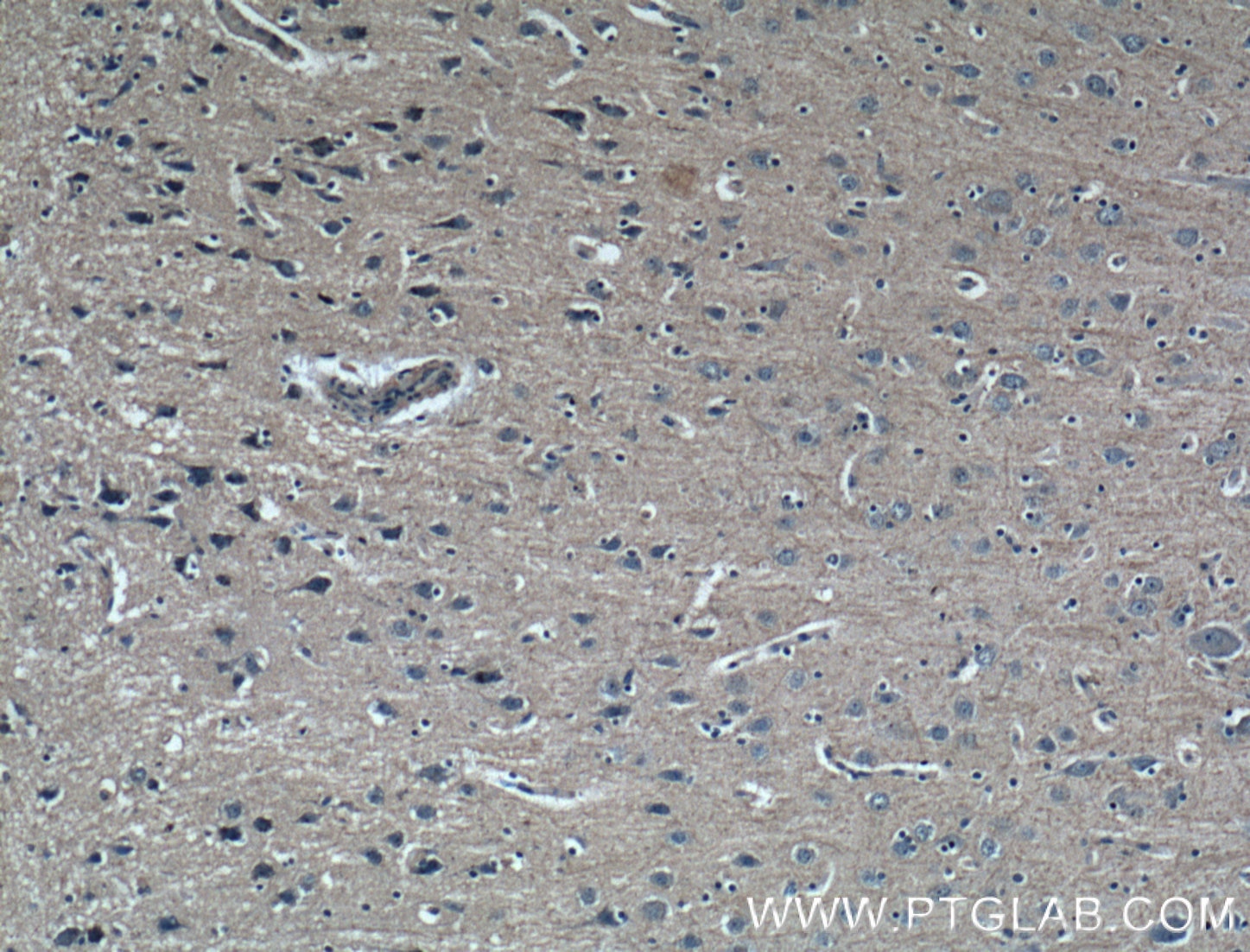 Immunohistochemistry (IHC) staining of human brain tissue using GMF Beta Monoclonal antibody (60062-1-Ig)