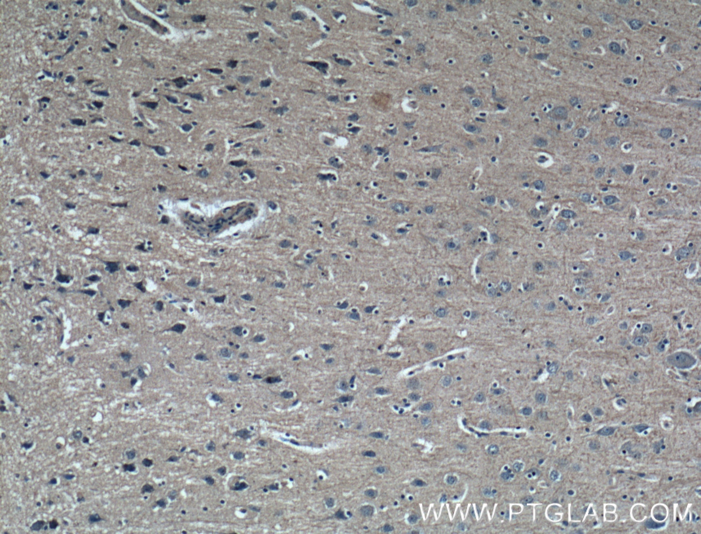 Immunohistochemistry (IHC) staining of human brain tissue using GMF Beta Monoclonal antibody (60062-1-Ig)