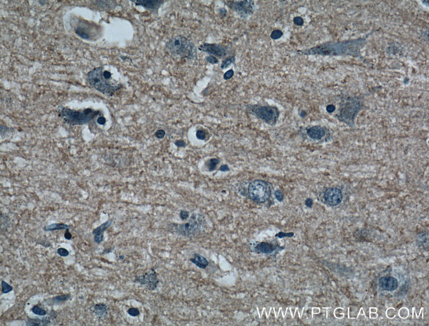 Immunohistochemistry (IHC) staining of human brain tissue using GMF Beta Monoclonal antibody (60062-1-Ig)