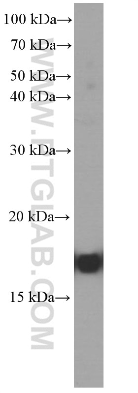 Western Blot (WB) analysis of fetal human brain tissue using GMF Beta Monoclonal antibody (60062-1-Ig)