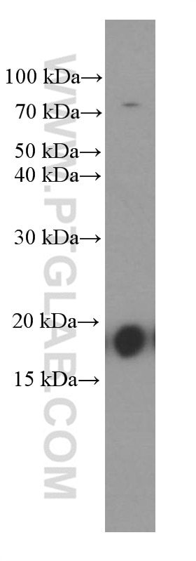 Western Blot (WB) analysis of pig liver tissue using GMF Beta Monoclonal antibody (60062-1-Ig)