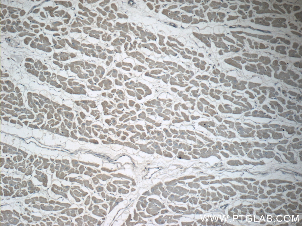 Immunohistochemistry (IHC) staining of human heart tissue using GMFG Polyclonal antibody (13625-1-AP)