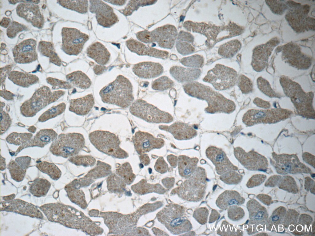 Immunohistochemistry (IHC) staining of human heart tissue using GMFG Polyclonal antibody (13625-1-AP)