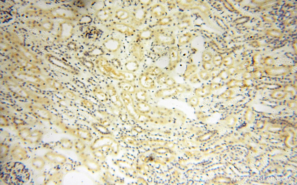 Immunohistochemistry (IHC) staining of human kidney tissue using GMFG Polyclonal antibody (13625-1-AP)