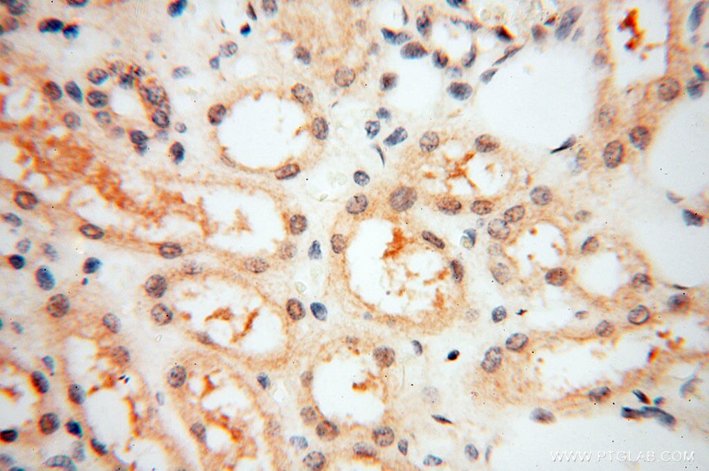 Immunohistochemistry (IHC) staining of human kidney tissue using GMFG Polyclonal antibody (13625-1-AP)