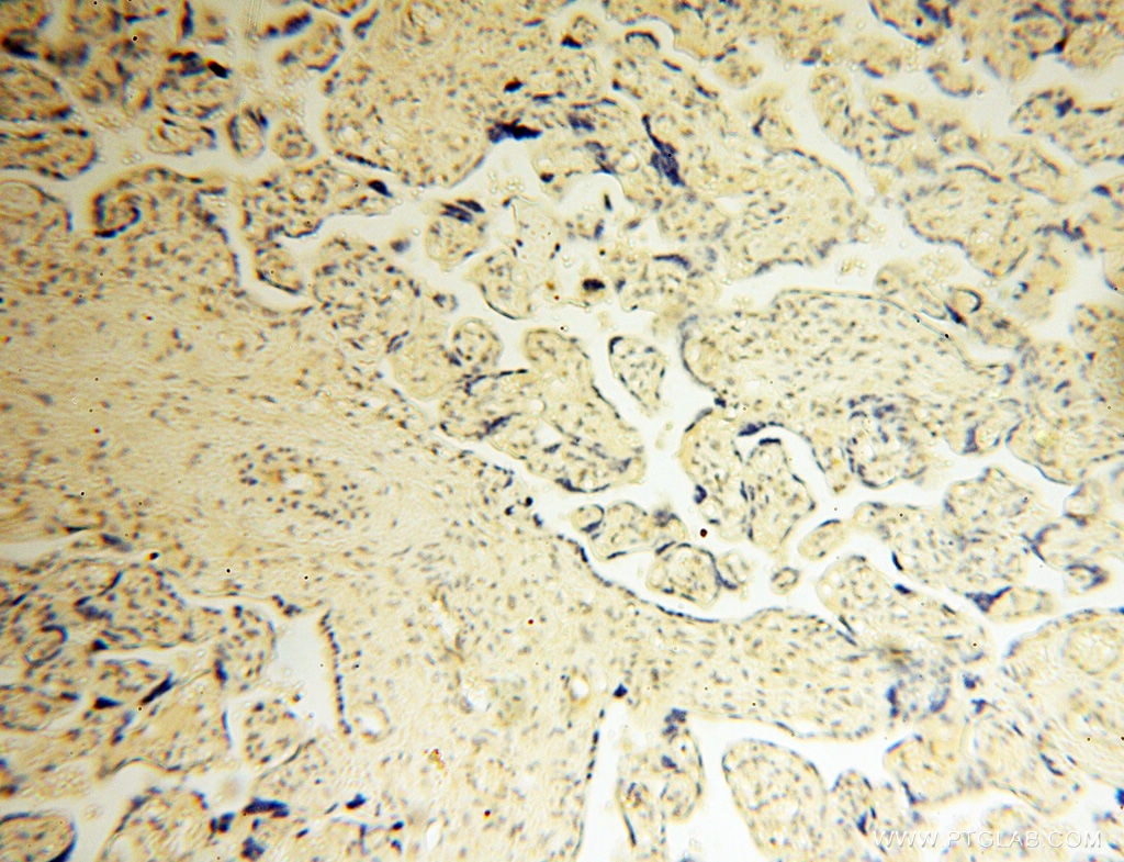 Immunohistochemistry (IHC) staining of human placenta tissue using GMFG Polyclonal antibody (13625-1-AP)