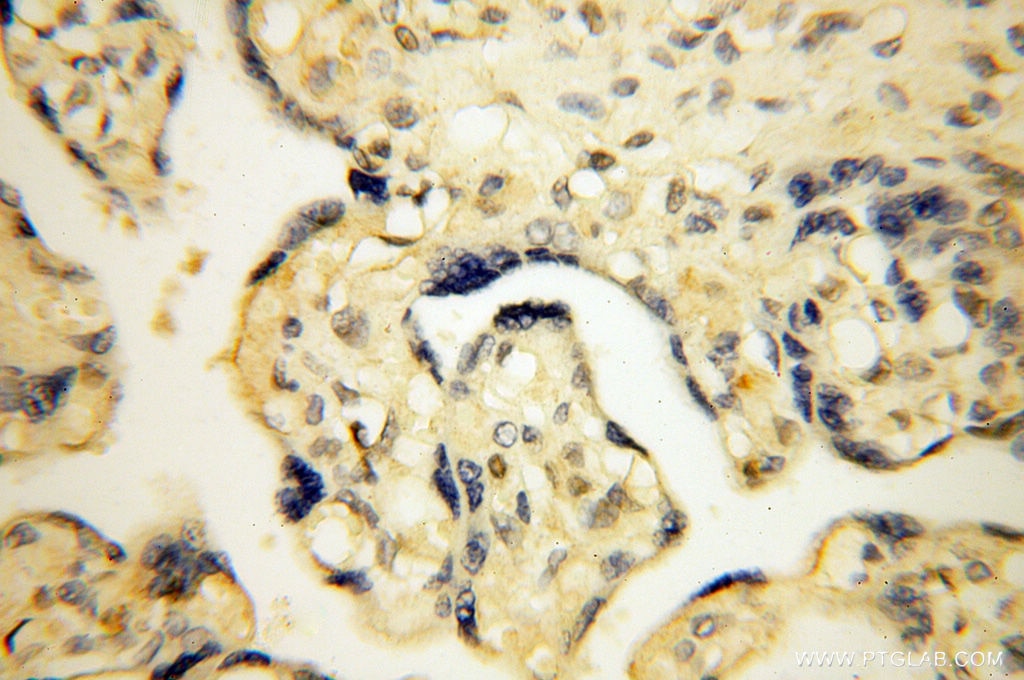 Immunohistochemistry (IHC) staining of human placenta tissue using GMFG Polyclonal antibody (13625-1-AP)