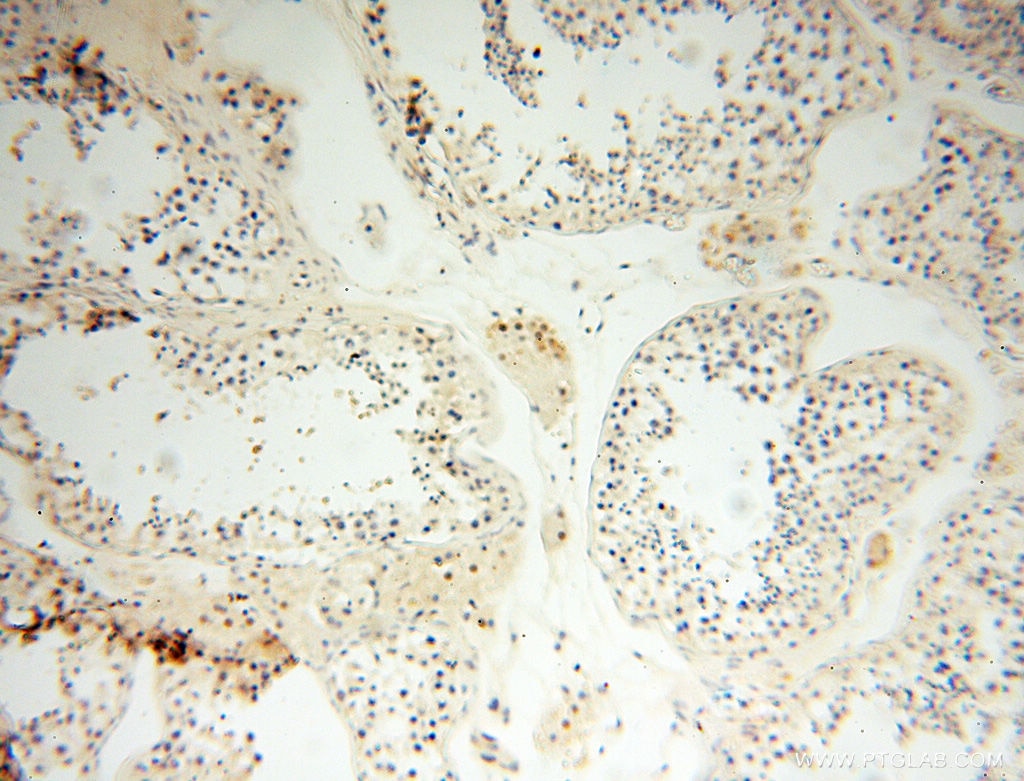 Immunohistochemistry (IHC) staining of human testis tissue using GMFG Polyclonal antibody (13625-1-AP)