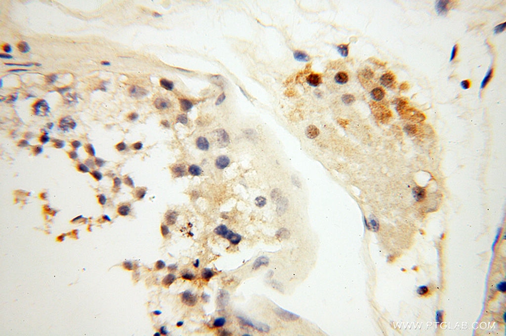 Immunohistochemistry (IHC) staining of human testis tissue using GMFG Polyclonal antibody (13625-1-AP)