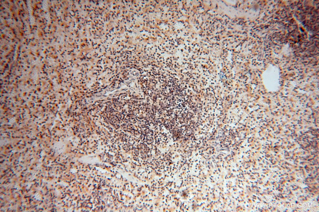 Immunohistochemistry (IHC) staining of human spleen tissue using GMFG Polyclonal antibody (13625-1-AP)