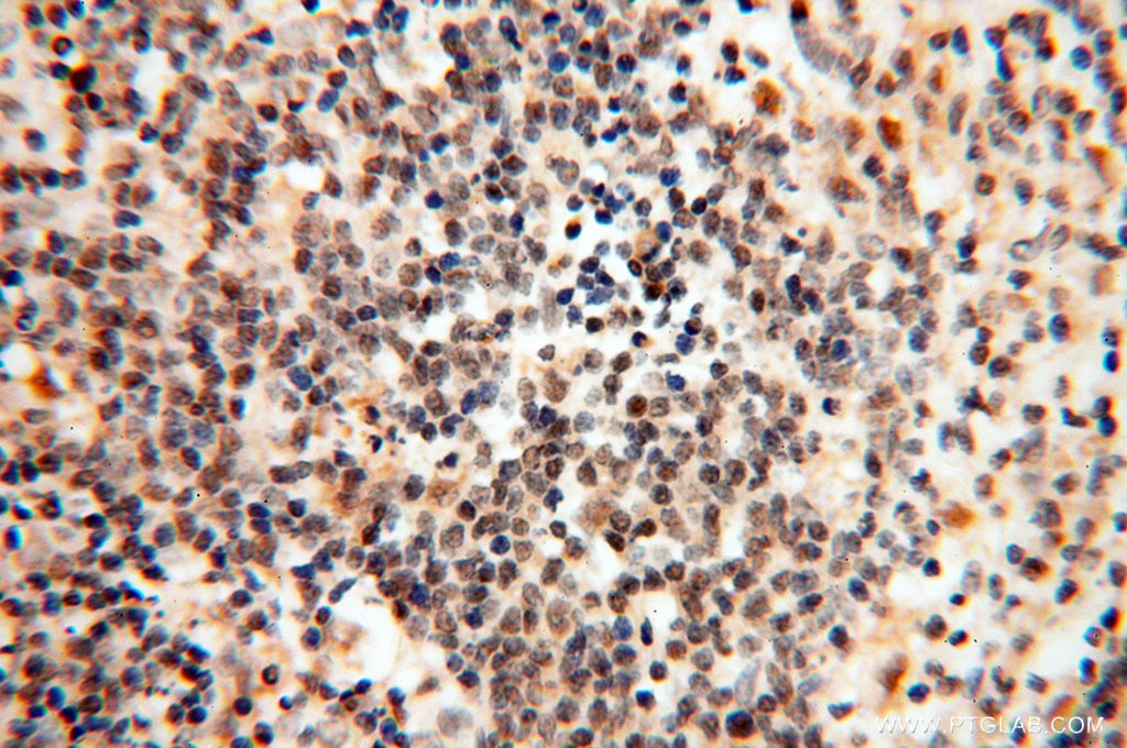 Immunohistochemistry (IHC) staining of human spleen tissue using GMFG Polyclonal antibody (13625-1-AP)