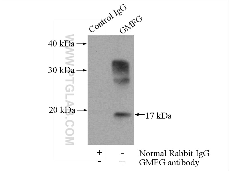 Immunoprecipitation (IP) experiment of mouse spleen tissue using GMFG Polyclonal antibody (13625-1-AP)