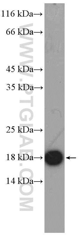 Western Blot (WB) analysis of rat brain tissue using GMFG Polyclonal antibody (13625-1-AP)