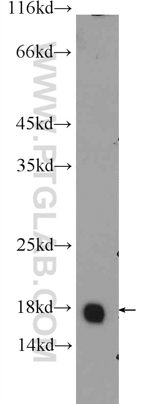 Western Blot (WB) analysis of human placenta tissue using GMFG Polyclonal antibody (13625-1-AP)