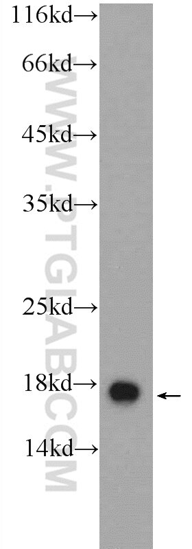 Western Blot (WB) analysis of mouse placenta tissue using GMFG Polyclonal antibody (13625-1-AP)
