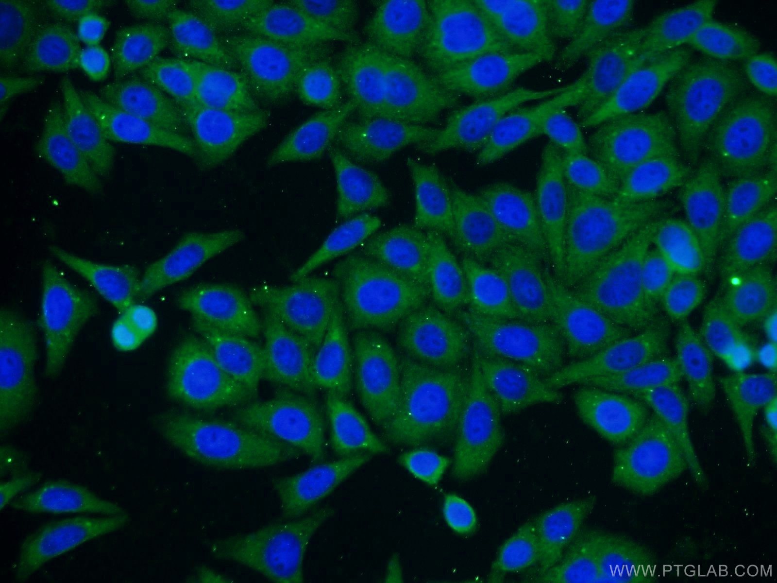 Immunofluorescence (IF) / fluorescent staining of HepG2 cells using GMIP Polyclonal antibody (25917-1-AP)