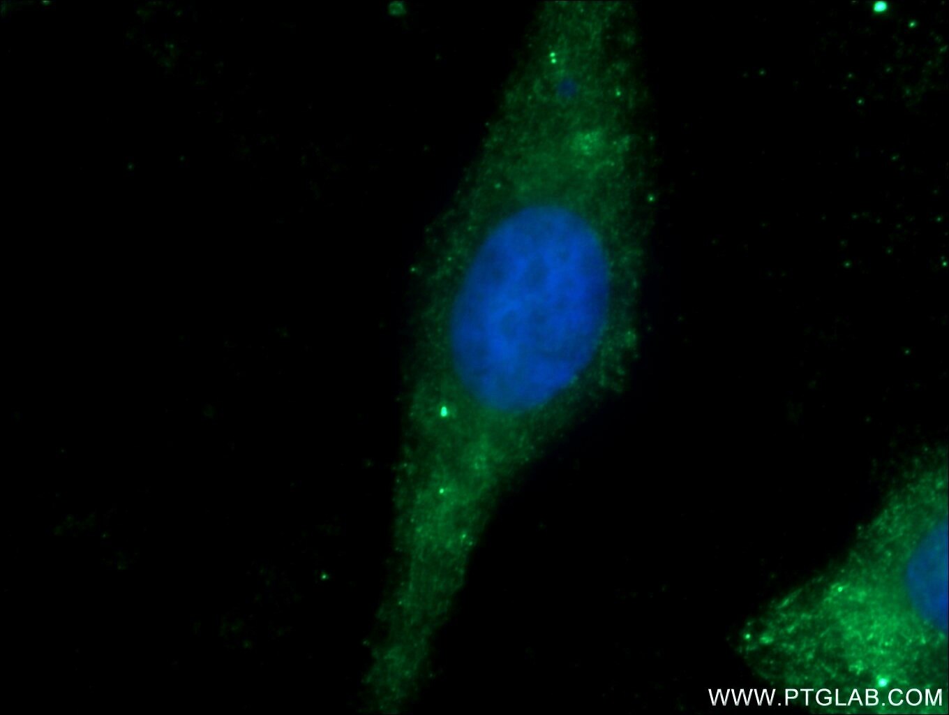 Immunofluorescence (IF) / fluorescent staining of HepG2 cells using GMIP Polyclonal antibody (25917-1-AP)