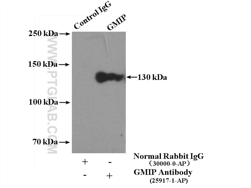 Immunoprecipitation (IP) experiment of Jurkat cells using GMIP Polyclonal antibody (25917-1-AP)