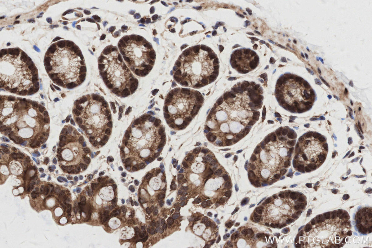 Immunohistochemistry (IHC) staining of mouse colon tissue using GMIP Recombinant monoclonal antibody (86101-2-RR)