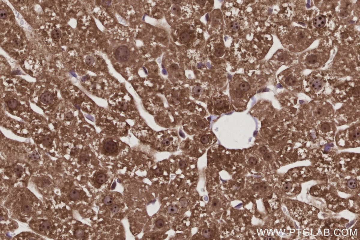 Immunohistochemistry (IHC) staining of mouse liver tissue using GMIP Recombinant monoclonal antibody (86101-2-RR)