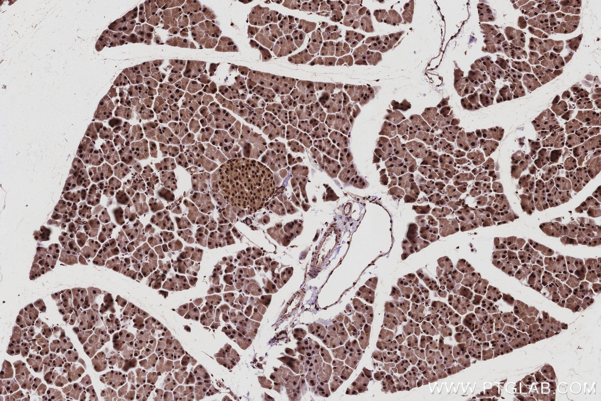 Immunohistochemistry (IHC) staining of mouse pancreas tissue using GMIP Recombinant monoclonal antibody (86101-2-RR)