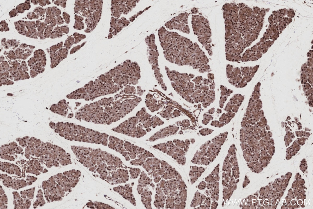 Immunohistochemistry (IHC) staining of rat pancreas tissue using GMIP Recombinant monoclonal antibody (86101-2-RR)