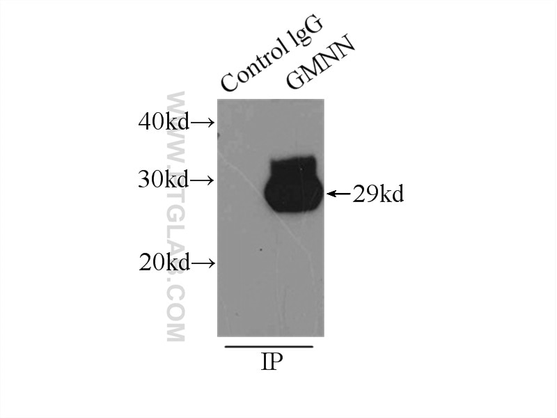 Immunoprecipitation (IP) experiment of HEK-293 cells using Geminin Polyclonal antibody (10802-1-AP)