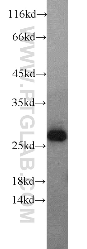 Western Blot (WB) analysis of human testis tissue using Geminin Polyclonal antibody (10802-1-AP)