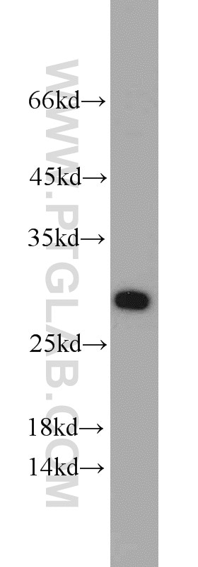 Western Blot (WB) analysis of HEK-293 cells using Geminin Polyclonal antibody (10802-1-AP)