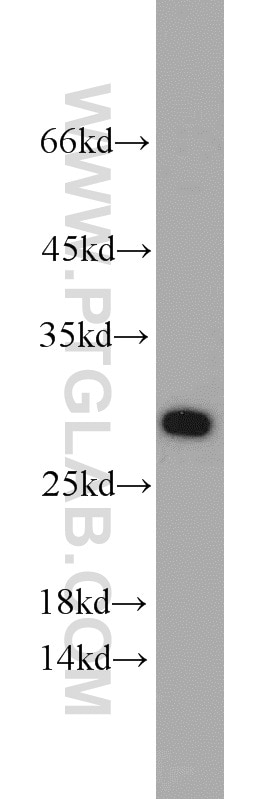 WB analysis of HEK-293 using 10802-1-AP