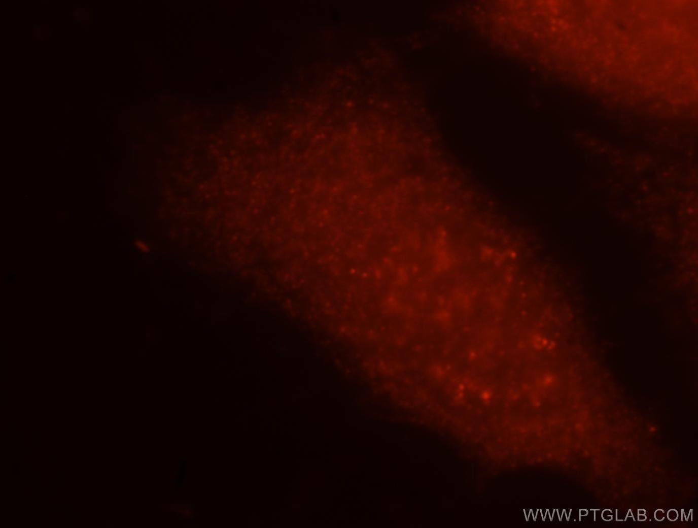 Immunofluorescence (IF) / fluorescent staining of HeLa cells using GMPPA Polyclonal antibody (15517-1-AP)