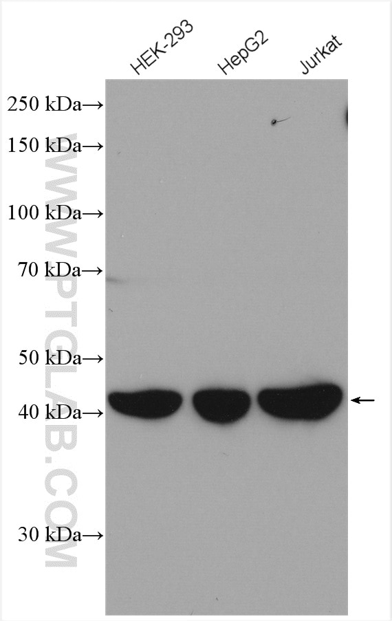 Western Blot (WB) analysis of various lysates using GMPPA Polyclonal antibody (15517-1-AP)