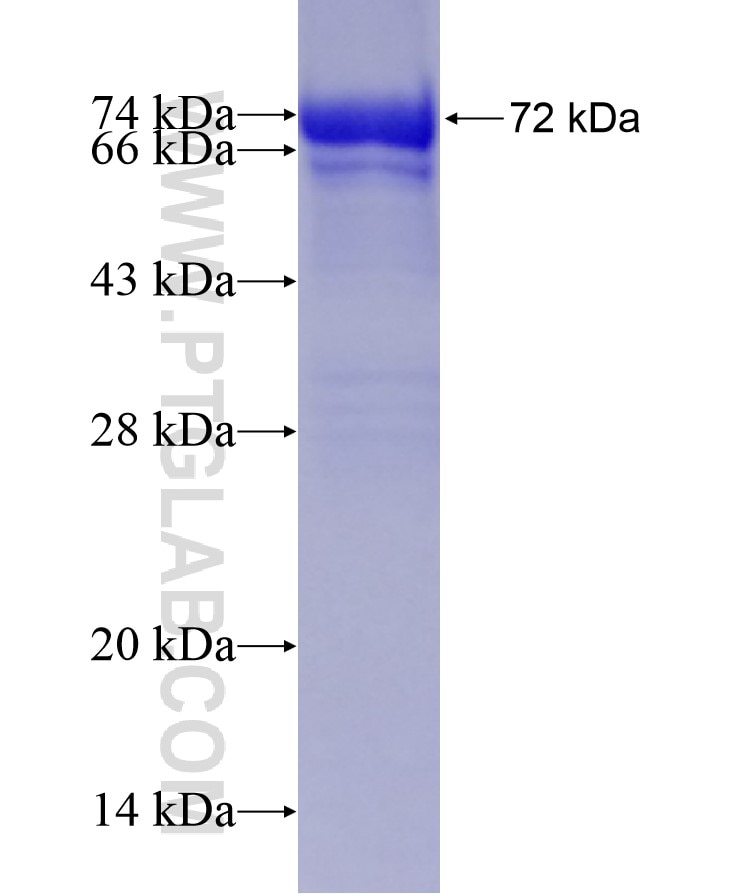 GMPPA fusion protein Ag7789 SDS-PAGE