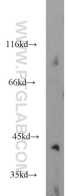 Western Blot (WB) analysis of mouse brain tissue using GMPPB Polyclonal antibody (15094-1-AP)