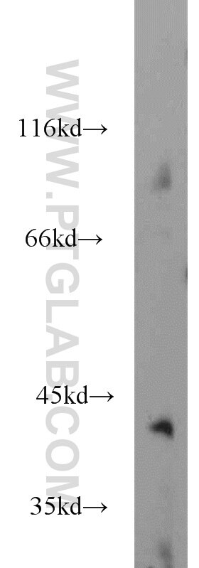 Western Blot (WB) analysis of mouse brain tissue using GMPPB Polyclonal antibody (15094-1-AP)