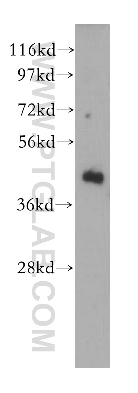 Western Blot (WB) analysis of mouse brain tissue using GMPPB Polyclonal antibody (15094-1-AP)