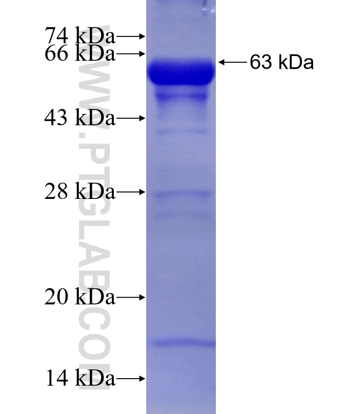 GMPPB fusion protein Ag7168 SDS-PAGE