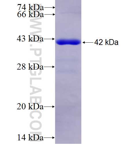 GMPPB fusion protein Ag7264 SDS-PAGE