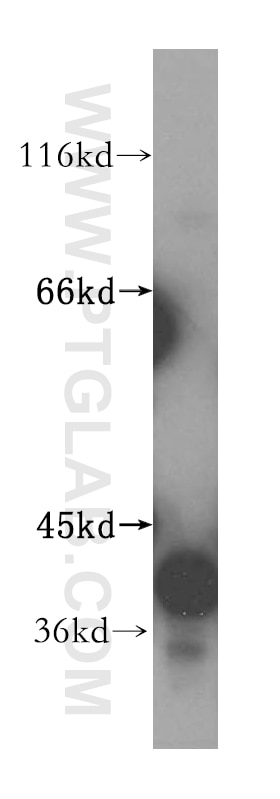 Western Blot (WB) analysis of mouse skeletal muscle tissue using GMPR 1/2 Polyclonal antibody (15683-1-AP)