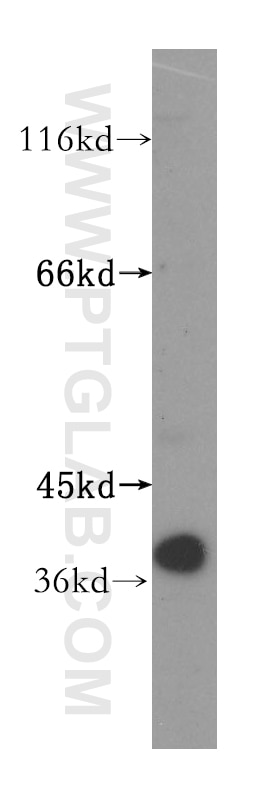 Western Blot (WB) analysis of mouse skin tissue using GMPR 1/2 Polyclonal antibody (15683-1-AP)